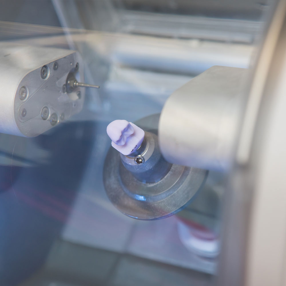 Inwood Dental and Implant Center | Bone Grafts, Ceramic Crowns and Oral Exams