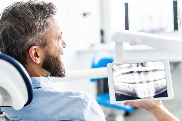 Inwood Dental and Implant Center | Sinus Lifts, Implant Restorations and Botox&reg;